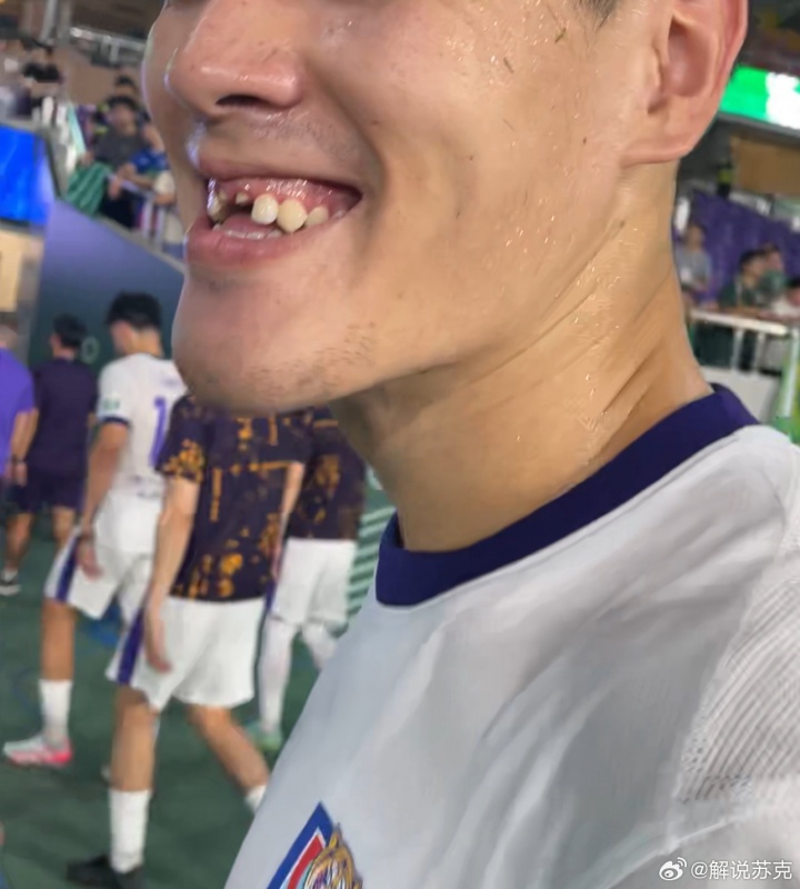 津门虎0-2负浙江遭遇失利,中卫王献钧拼抢中门牙遭撞击脱落